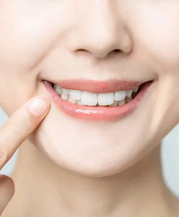 Dental treatment smile